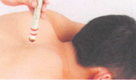 咳嗽艾灸哪个部位图解