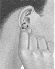 肩周炎按摩部位图解