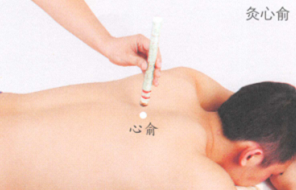 冠心病艾灸哪个部位图解