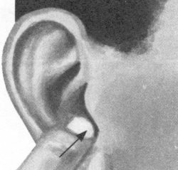 耳鸣-耳痛按摩部位图解