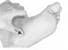 腰椎间盘突出症按摩部位图解