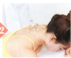 发热拔罐部位图解