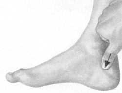 前列腺疾病按摩部位图解