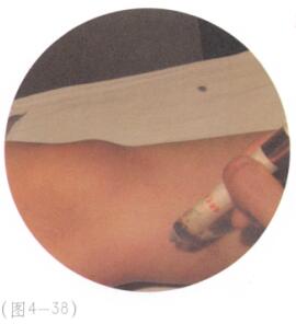 关节疼痛艾灸哪个部位图解