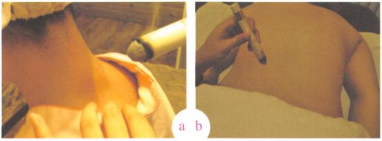 更年期综合征艾灸哪个部位图解