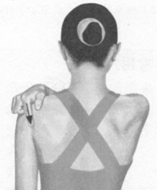 肩周炎按摩部位图解