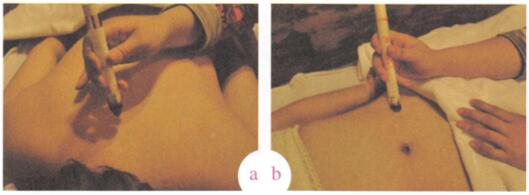 强身保健艾灸哪个部位图解