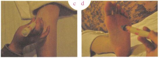 更年期综合征艾灸哪个部位图解