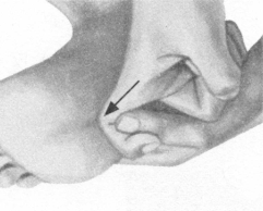 鼻炎按摩部位图解