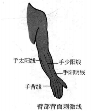 飞针技术臂部刺激线