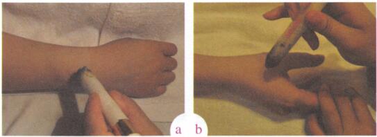 中风艾灸哪个部位图解