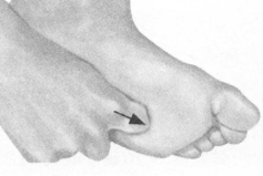 腰椎间盘突出症按摩部位图解