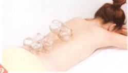 闭经拔罐部位图解