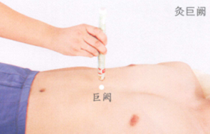 冠心病艾灸哪个部位图解