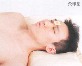 皱纹艾灸哪个部位图解