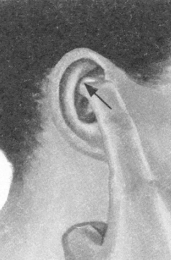 腰椎间盘突出症按摩部位图解