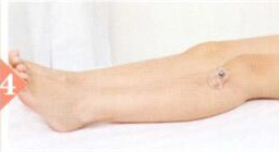 妊娠呕吐拔罐部位图解