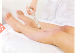 肺结核艾灸哪个部位图解