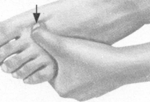 咳喘病按摩部位图解