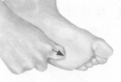 失眠症按摩部位图解