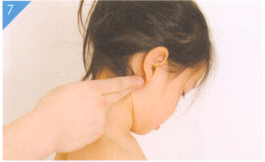 小儿冻疮按摩部位图解