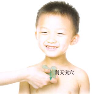 百日咳刮痧部位图解