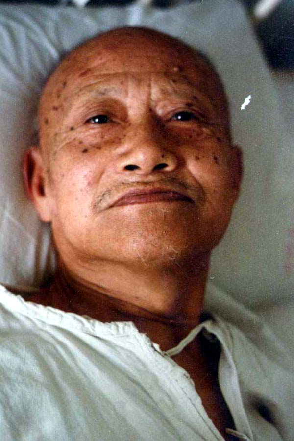 中医望色之面黑而沉