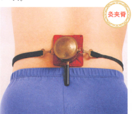 强直性脊柱炎艾灸哪个部位图解