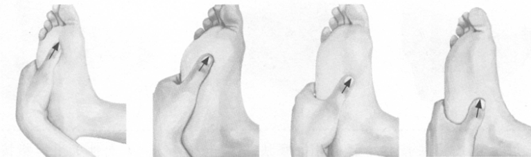 慢性盆腔炎按摩部位图解