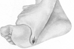 近视按摩部位图解