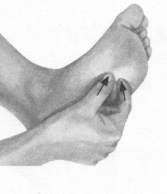 耳鸣-耳聋按摩部位图解