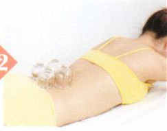 慢性盆腔炎拔罐部位图解