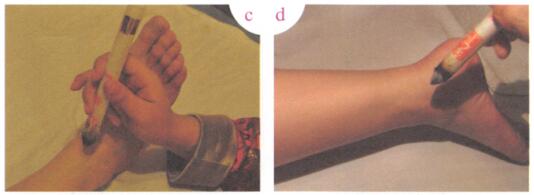 中风艾灸哪个部位图解