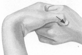 腰椎间盘突出症按摩部位图解