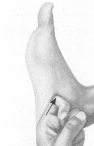 鼻炎按摩部位图解