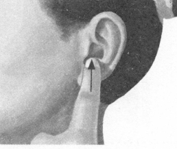 高脂血症按摩部位图解