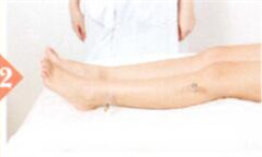 坐骨神经痛拔罐部位图解