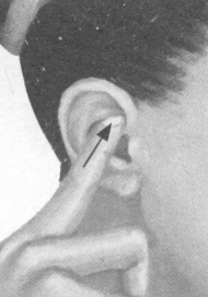 肥胖症按摩部位图解