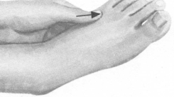 冠心病按摩部位图解