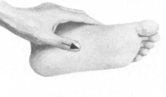 高脂血症按摩部位图解