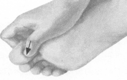 腰椎间盘突出症按摩部位图解