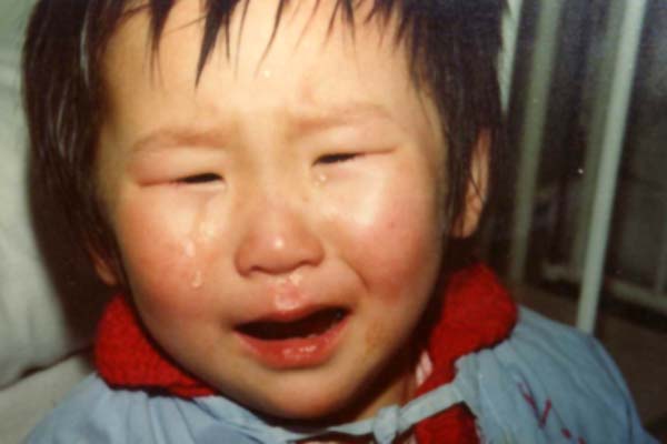 中医望口与唇之唇腮红