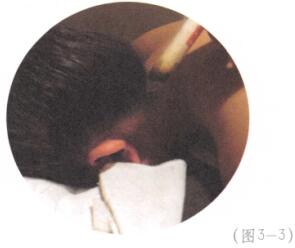 防治面瘫艾灸哪个部位图解