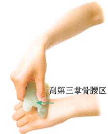 腰痛刮痧部位图解