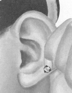 胃肠炎按摩部位图解