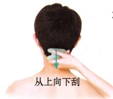 眩晕刮痧部位图解