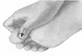 肩周炎按摩部位图解