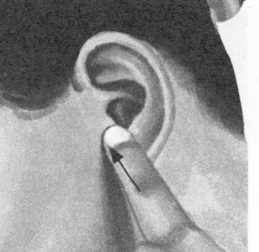 耳鸣-耳痛按摩部位图解