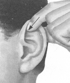 风湿病按摩部位图解