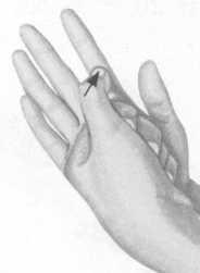 肥胖症按摩部位图解